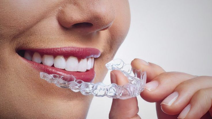 ODF Invisible par Gouttière 